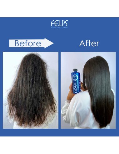 Felps Omega Zero Unique Resistance Nanoplastia...